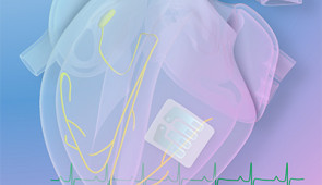 Illustration of the implant on a human heart. Credit: Zexu Lin