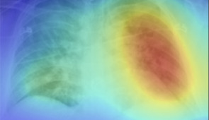 Generated heat maps appropriately highlighted abnormalities in the lung fields in those images accurately labeled as COVID-19 positive.