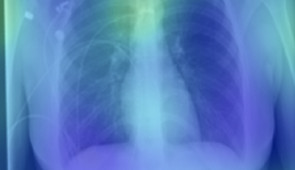 Images which were accurately labeled as negative for COVID-19.