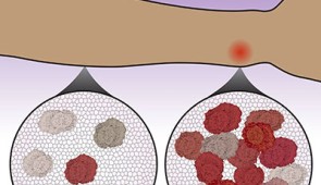 The number of immune cells that migrate to a location determines how much the immune system activates to respond to a threat.