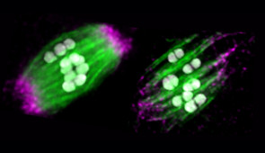 Shown are a normal spindle in an egg cell (left) compared to a spindle after removal of the motor protein dynein (right). Microtubules are shown in green, chromosomes are in white, and spindle poles are labeled in magenta. Dynein depletion disrupts proper spindle organization.