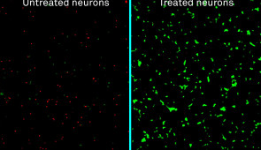 Labeled micrographs of human neurons exposed to amyloid-beta proteins and either left untreated (left) or treated with the new nanotherapy developed at Northwestern (right). Dead neurons are stained in red; live neurons are green.