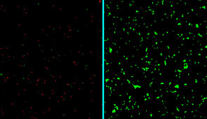 Unlabeled micrographs of human neurons exposed to amyloid-beta proteins and either left untreated (left) or treated with the new nanotherapy developed at Northwestern (right). Dead neurons are stained in red; live neurons are green.