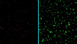 Unlabeled micrographs of human neurons exposed to amyloid-beta proteins and either left untreated (left) or treated with the new nanotherapy developed at Northwestern (right). Dead neurons are stained in red; live neurons are green.