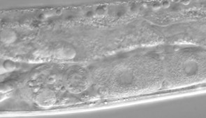 This image contrasts relatively normal oocytes (at the bottom right) with abnormally shapped ones (bottom left).