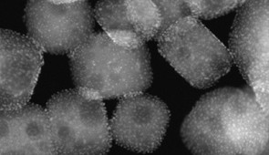 An electron micrograph of platinum nanoparticles deposited onto a perovskite nanotube.