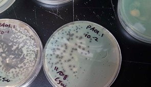 The dark spots in the dishes mark areas where phage burst out of the bacteria, killing them.