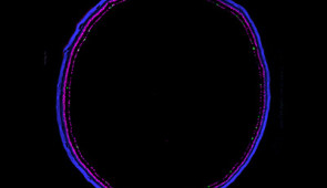 Retinal section from a mouse where cell nuclei are labeled in blue, inhibitory cells are labeled with magenta, and ipRGCs are labeled in green.