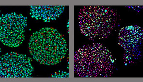 A side-by-side comparison of cells supported by the oxygenation device (left) and cells without the device (right). Living cells are shown in green; dead cells are red.