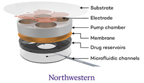 A peek inside the closed-loop drug-delivery system.