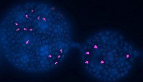 A portion of the ovariole of female fruit fly. The larger spheres (two can be seen) are egg chambers. Each chamber contains a future egg and associated nurse cells (some of these can be seen as hazy out of focus outlines). The covering sheet is made of follicle cells (shown in blue). Fluoxetine (Prozac) increases division (in magenta) of follicle cells in flies.
