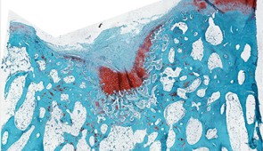 Control cartilage (stained with safranin), with a defect on the upper left of the image.