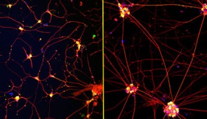 Fluorescent images of human neurons (stained with red, green and blue) growing on coatings with fast-moving molecules (left) or conventional laminin (right) for 72 hours. Neurons attached and spread homogenously on the highly mobile coating but remained clumped together on the laminin coating.