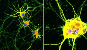 Fluorescent images of human neurons (stained with red, green and blue) growing on coatings with fast-moving molecules (left) or conventional laminin (right) for 60 days. Neurons spread homogenously and showed more complex branching on the highly mobile coating developed at Northwestern.