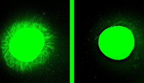 Fluorescent micrographs showing increased neurite outgrowth from a human spinal cord organoid treated with fast-moving “dancing molecules” (left) compared to one treated with slow-moving molecules (right) containing the same bioactive signals.