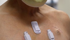 Wearable devices stick to the chest of an adult patient. Credit: Northwestern Medicine