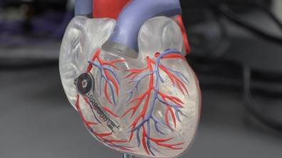 Sitting on a model heart, the battery-free transient, bioresorbable pacemaker can temporarily pace a heart.