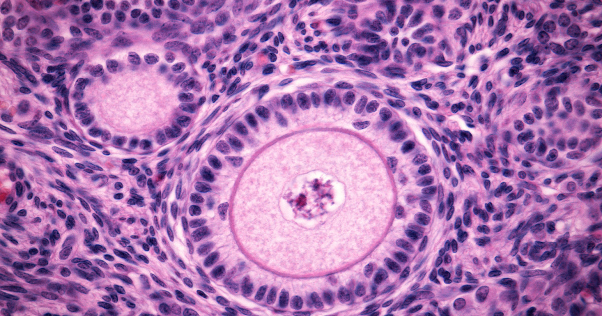 Study finds postmenopausal ovaries remain biologically active with age