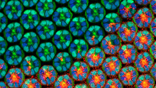 drosophila eye