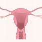 Illustrated image of uterus without ovarian cancer
