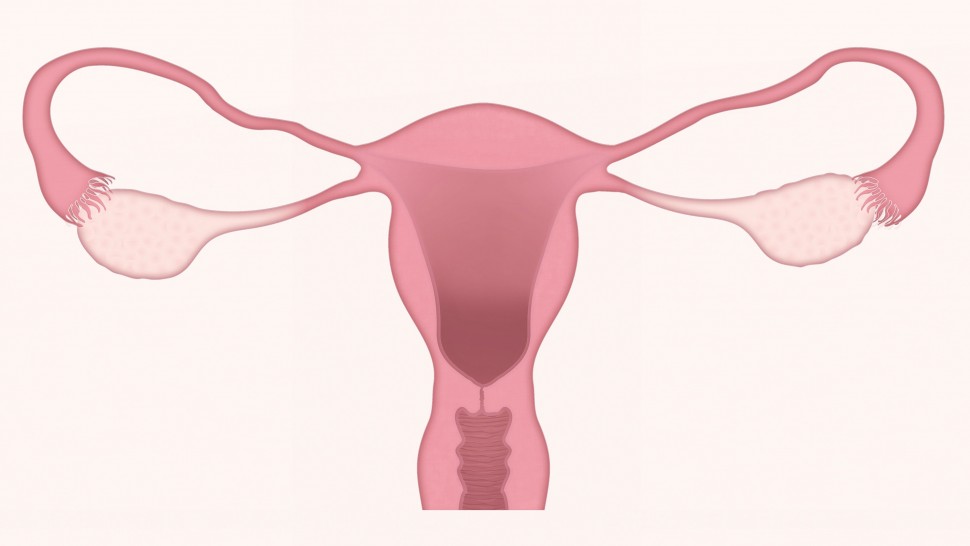 Illustrated image of uterus without ovarian cancer