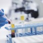 Hematopoietic stem cells are taken from the patient’s bone marrow or blood, then their immune stem is wiped out with chemotherapy. 