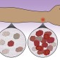 leonard immune cells