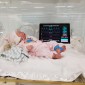 rogers next-gen nicu