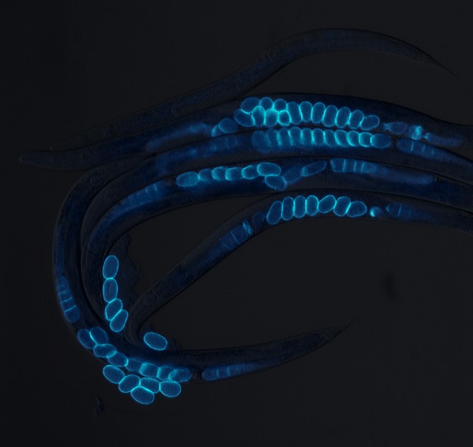 Image of the transparent roundworm C. elegans