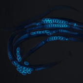 Image of the transparent roundworm C. elegans