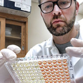 covid-19 antibody test