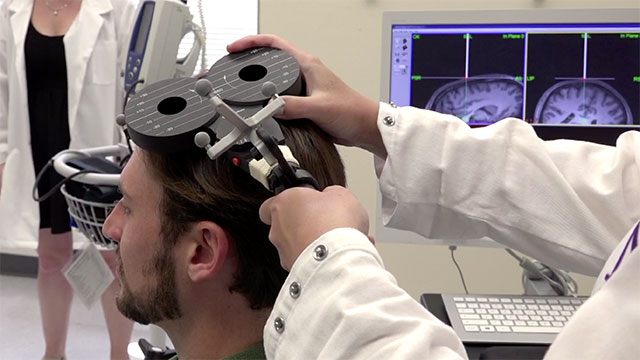 brain stimulation improves memory