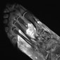 radiological imaging covid