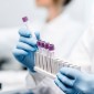 research funding