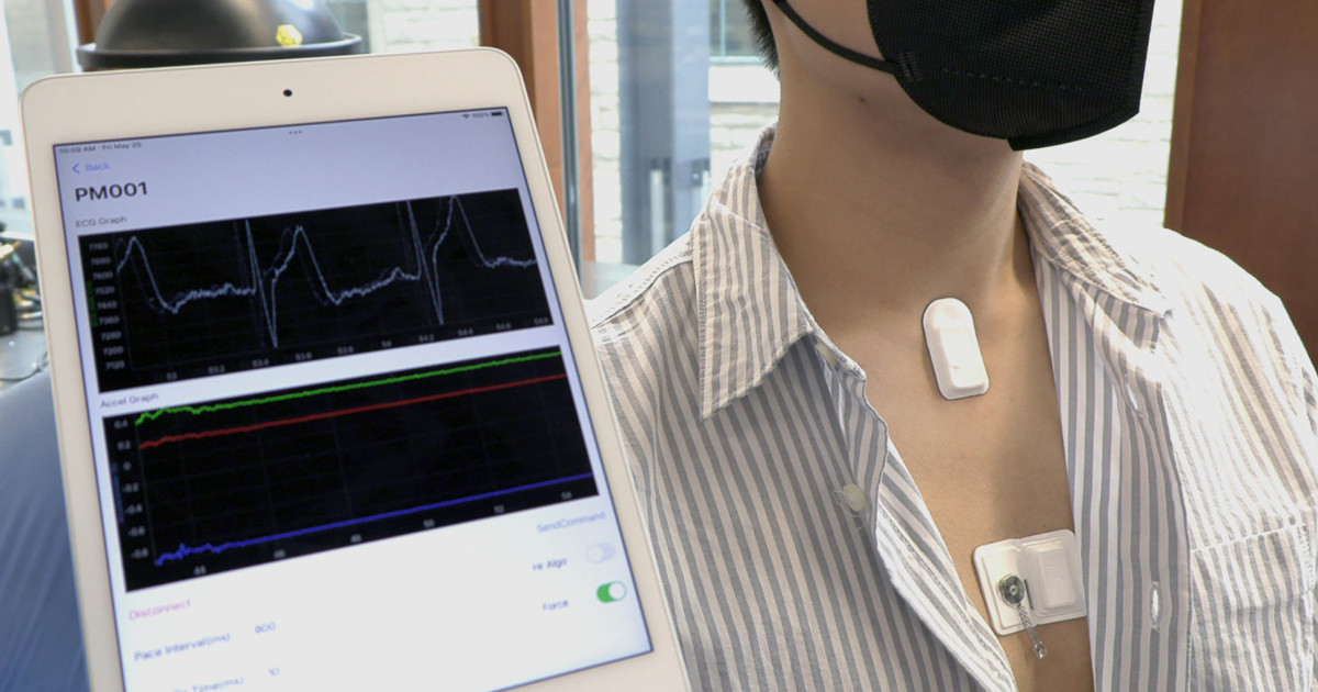 Fob Remote Pacemaker Smart, dissolving pacemaker communicates with body-area sensor and ...