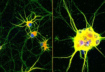 Mature ‘lab grown’ neurons hold promise for neurodegenerative disease
