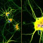 mature neurons with dancing molecules