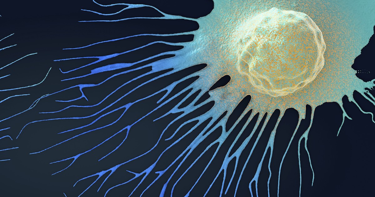 Why do some cells become resistant to anti-cancer therapies?