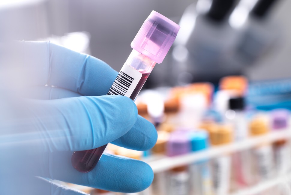 A gloved hand holds a vial of blood 