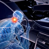 Chronic pain and anxiety after whiplash injury