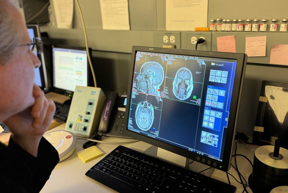 Social cognitive network regions of brain connected to amygdala