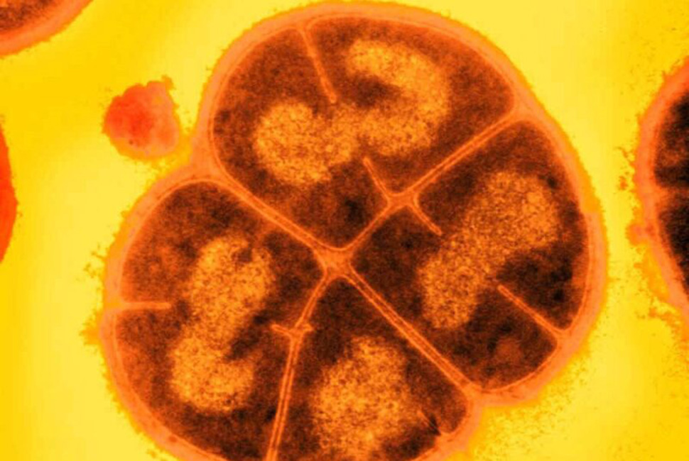 How 'Conan the Bacterium' withstands extreme radiation