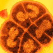 Deinococcus radiodurans