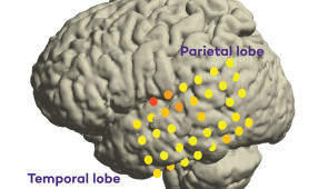 Scientists have, for the first time, identified brain regions outside the front lobe involved in the intent to produce speech. (Credit: Northwestern University)