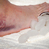 muscle injuries