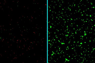 neurons alzheimer nanotherapy