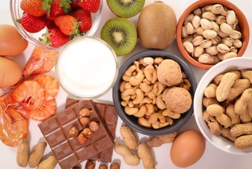 food allergies