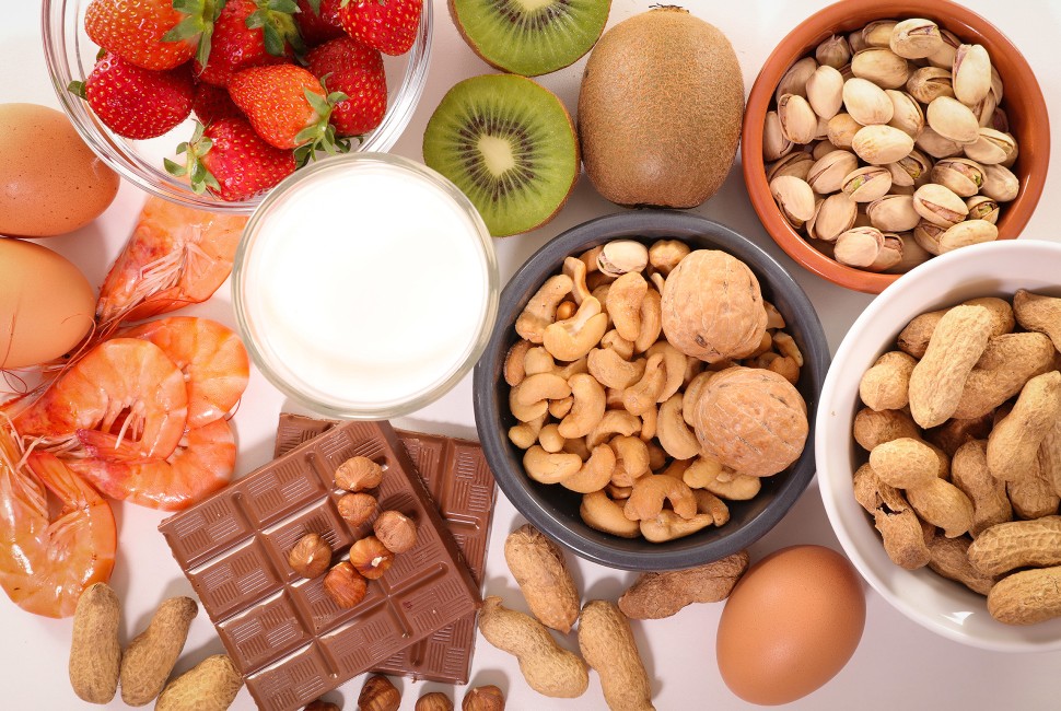food allergies