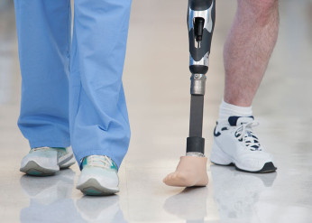 Leg and foot amputations in Illinois