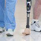 Leg and foot amputations in Illinois